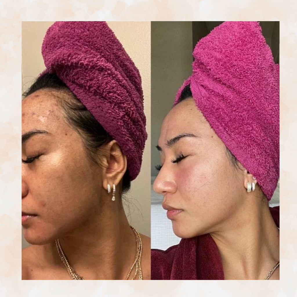 Kojic Acid Cleansing Pads
