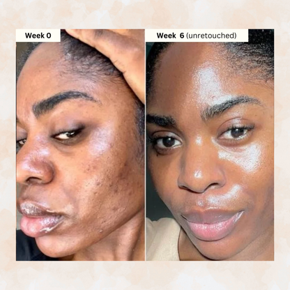 Kojic Acid Cleansing Pads